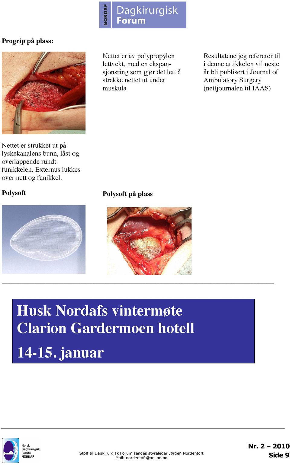 Surgery (nettjournalen til IAAS) Nettet er strukket ut på lyskekanalens bunn, låst og overlappende rundt funikkelen.