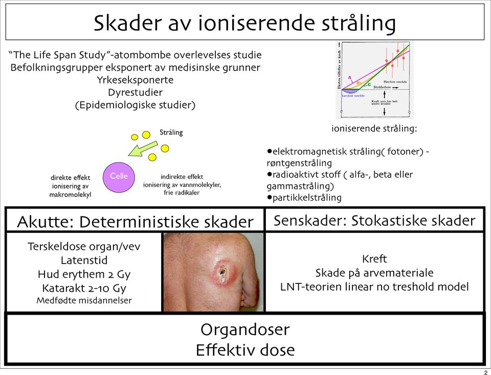 erythem 2 Gy Katarakt 2-10 Gy Medfødte misdannelser elektromagnetisk stråling( fotoner) - røntgenstråling radioaktivt stoff ( alfa-, beta eller