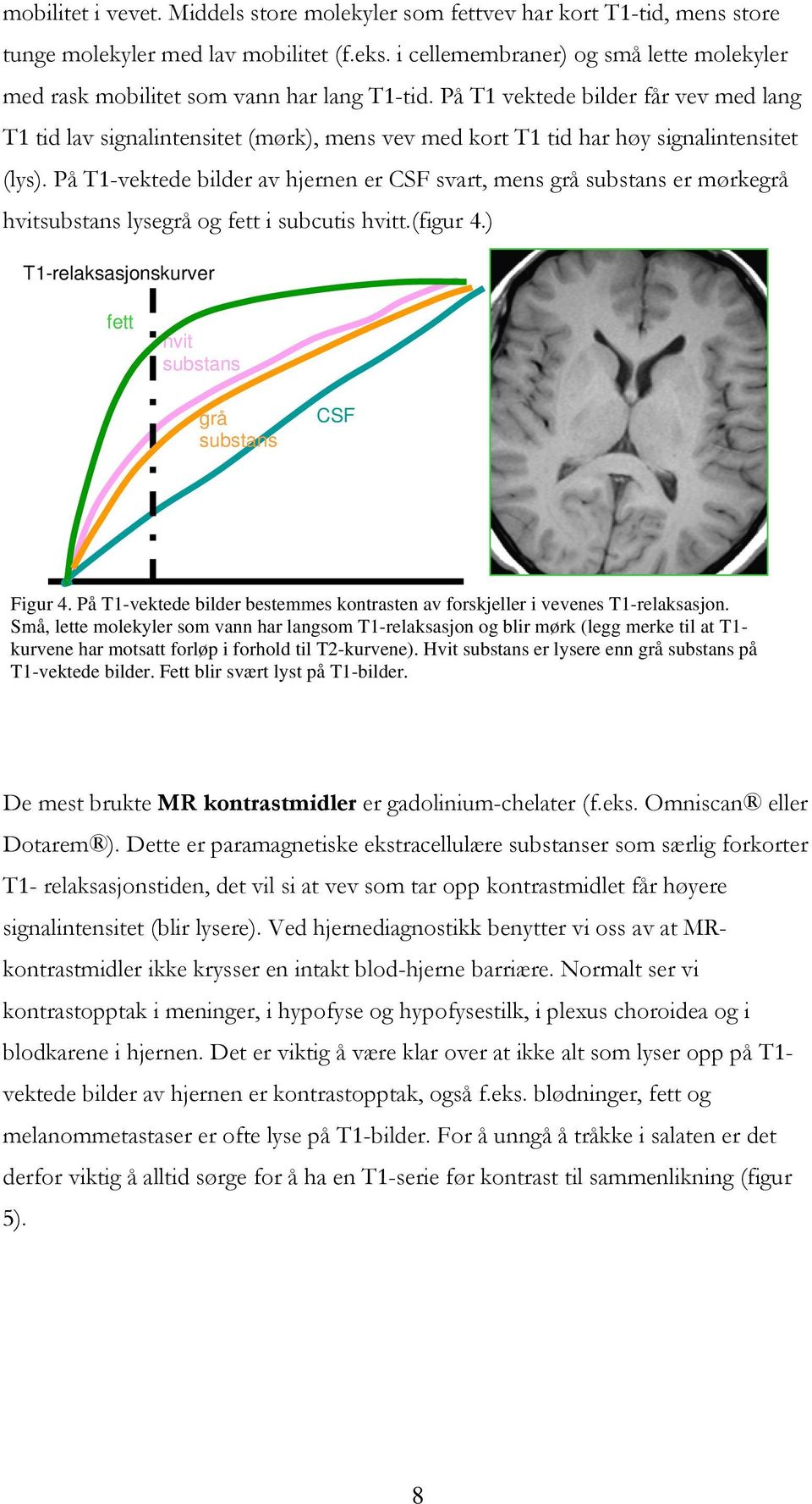 På T1 vektede bilder får vev med lang T1 tid lav signalintensitet (mørk), mens vev med kort T1 tid har høy signalintensitet (lys).