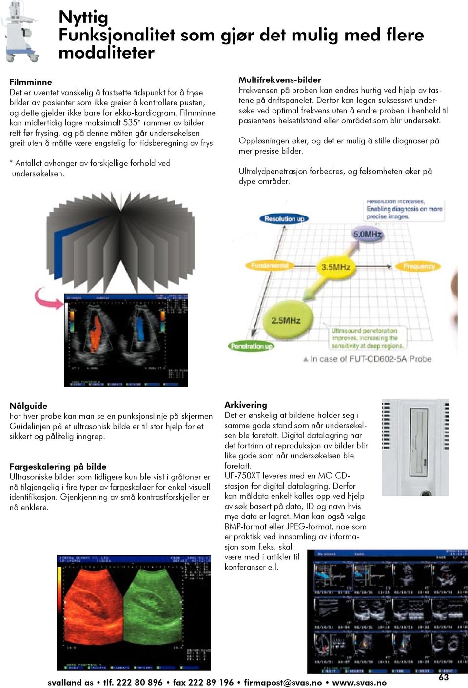 Filmminne kan midlertidig lagre maksimalt 535* rammer av bilder While not rett limited før frysing, to echocardiogram, og på denne måten it is unexpectedly går undersøkelsen difficult to greit take