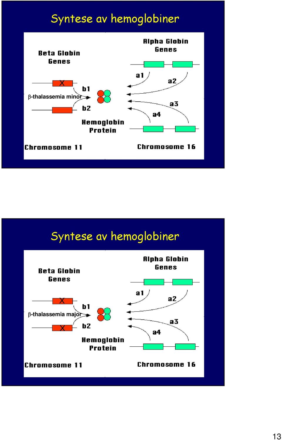 -thalassemia major X 13