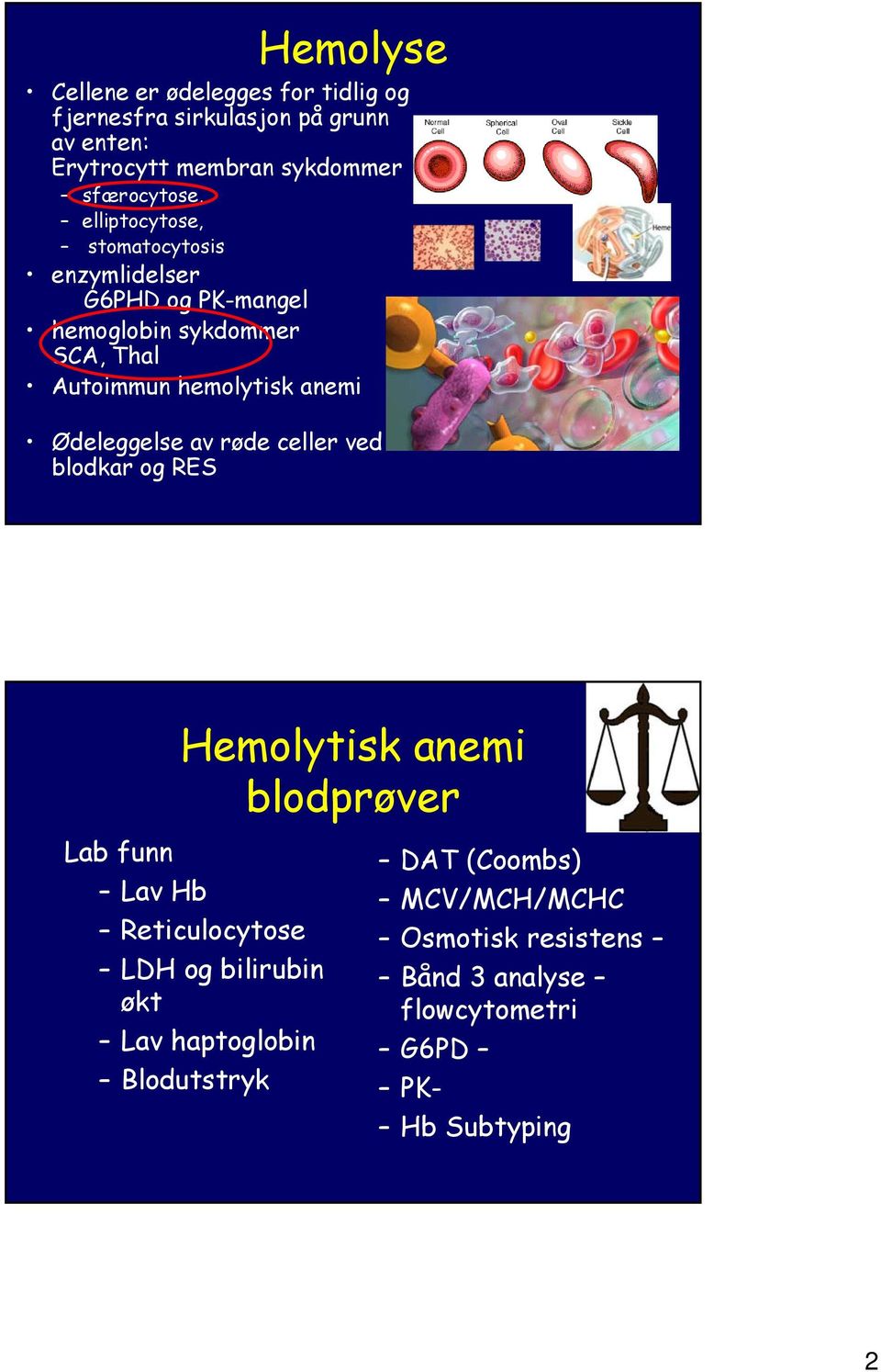 hemolytisk anemi Ødeleggelse av røde celler ved blodkar og RES Hemolytisk anemi blodprøver Lab funn Lav Hb Reticulocytose