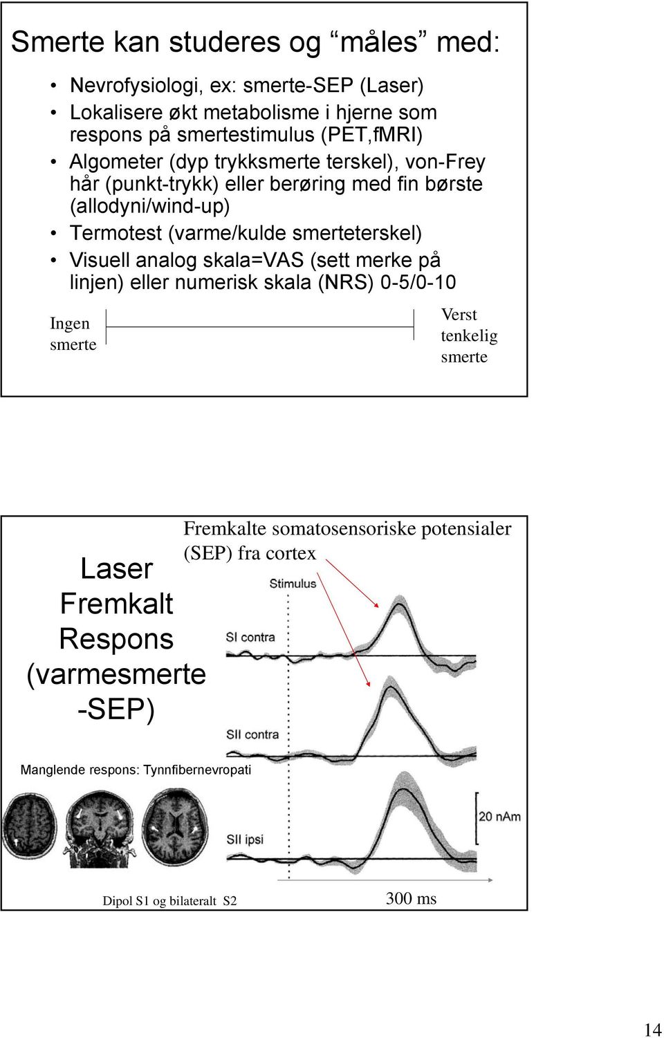 smerteterskel) Visuell analog skala=vas (sett merke på linjen) eller numerisk skala (NRS) 0-5/0-10 Ingen smerte Verst tenkelig smerte Laser