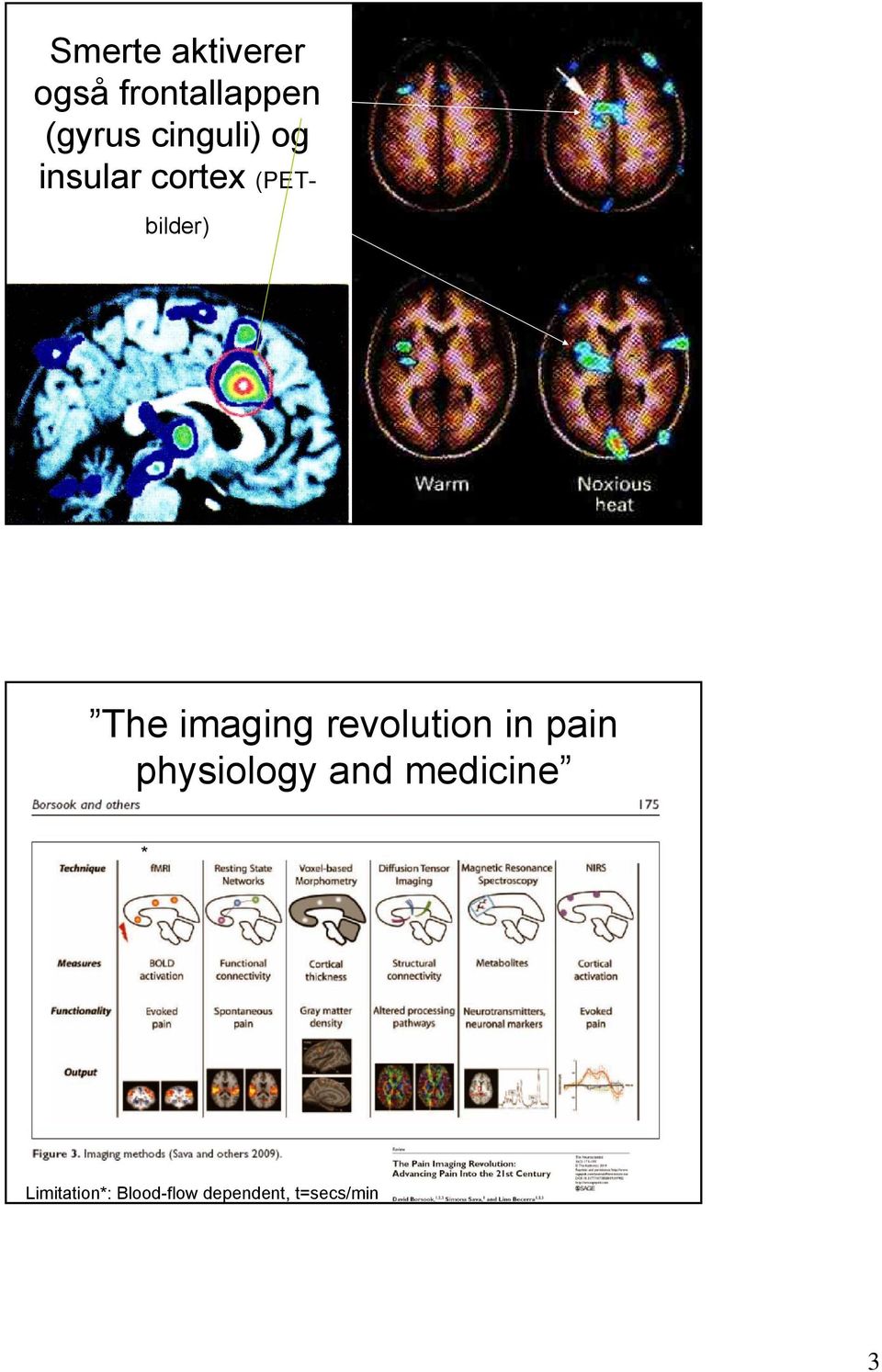 imaging revolution in pain physiology and