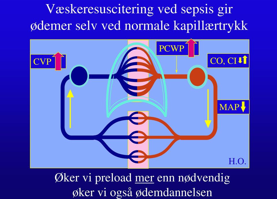 CVP PCWP CO, CI MAP Øker vi preload