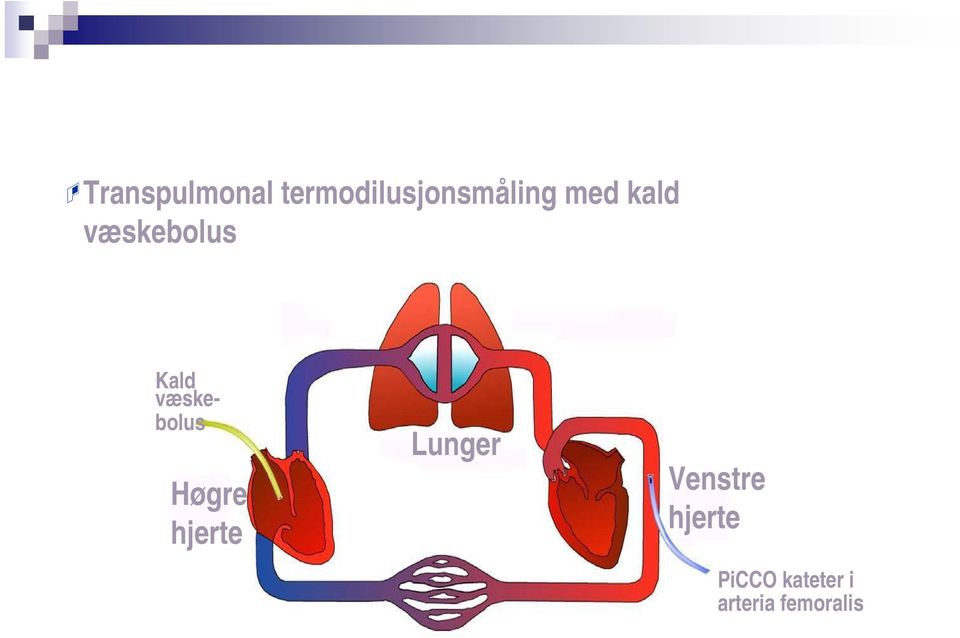 kald væskebolus Kald væskebolus Høgre