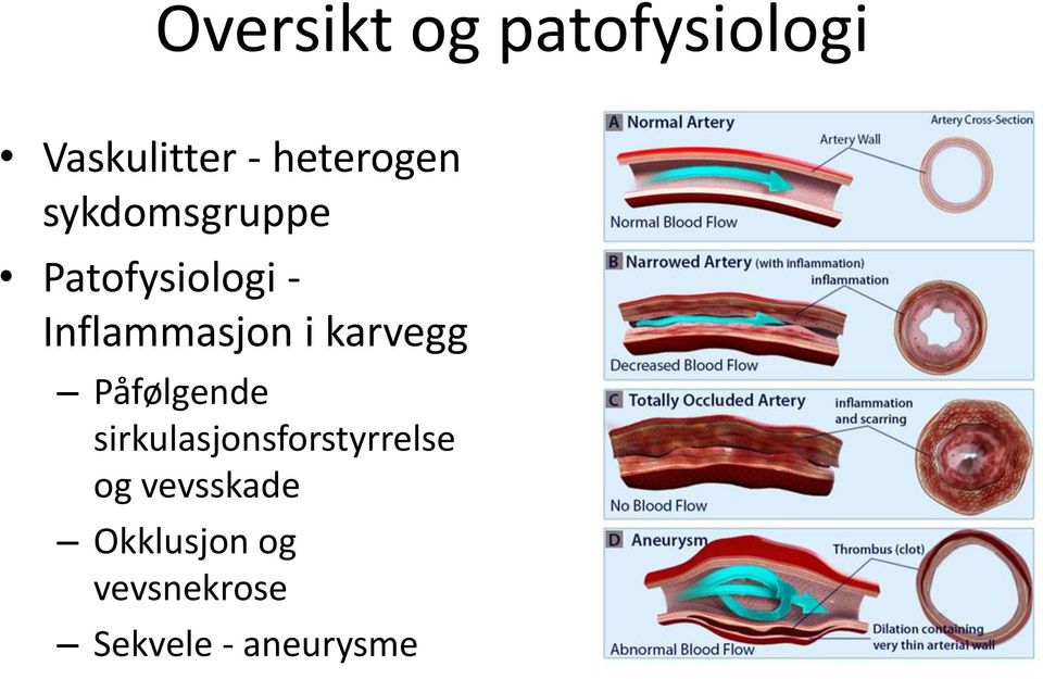 Inflammasjon i karvegg Påfølgende