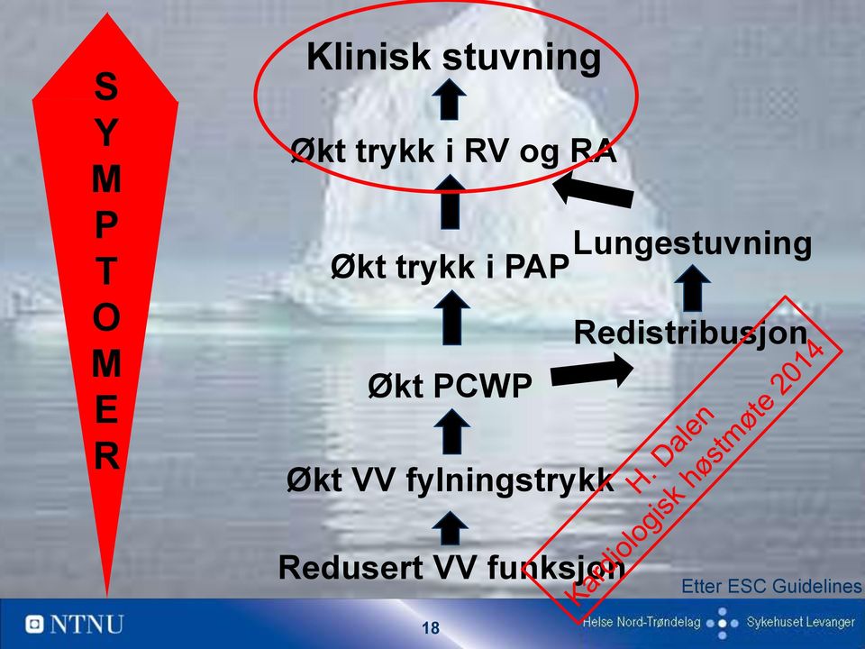 Lungestuvning Økt trykk i PAP Økt PCWP Økt VV fylningstrykk