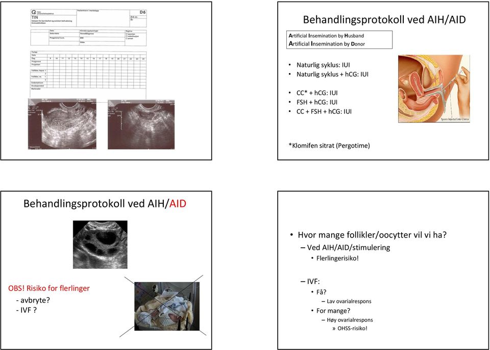 (Pergotime) Behandlingsprotokoll ved AIH/AID Hvor mange follikler/oocytter vil vi ha?