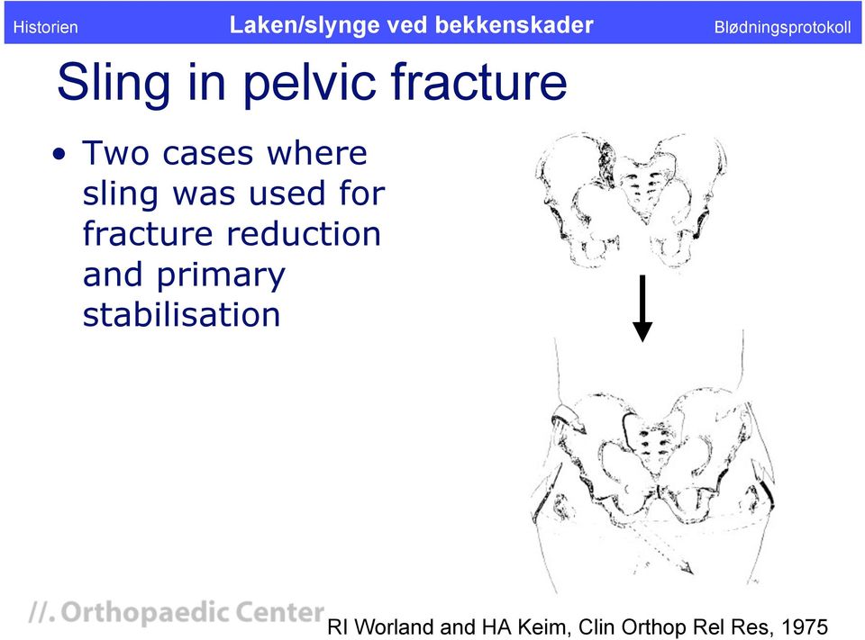 reduction and primary stabilisation RI