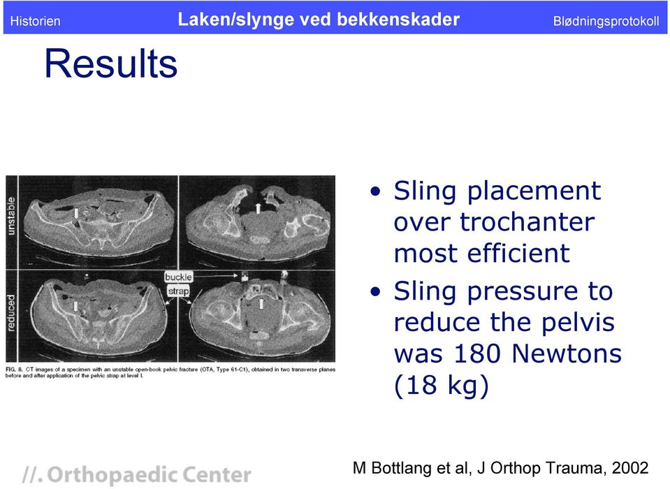 pressure to reduce the pelvis was 180