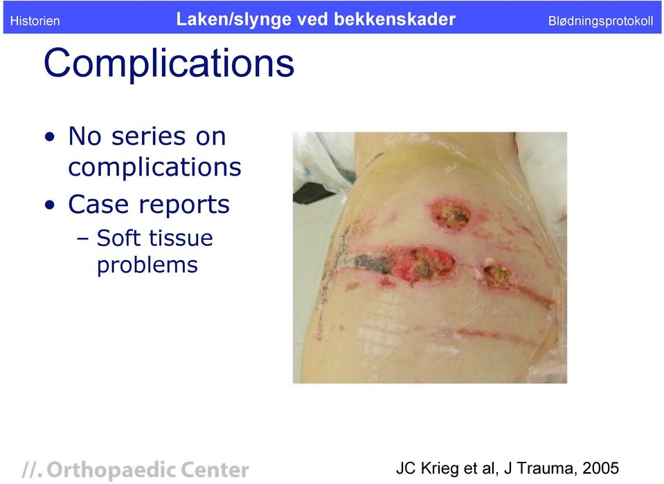 Soft tissue problems JC