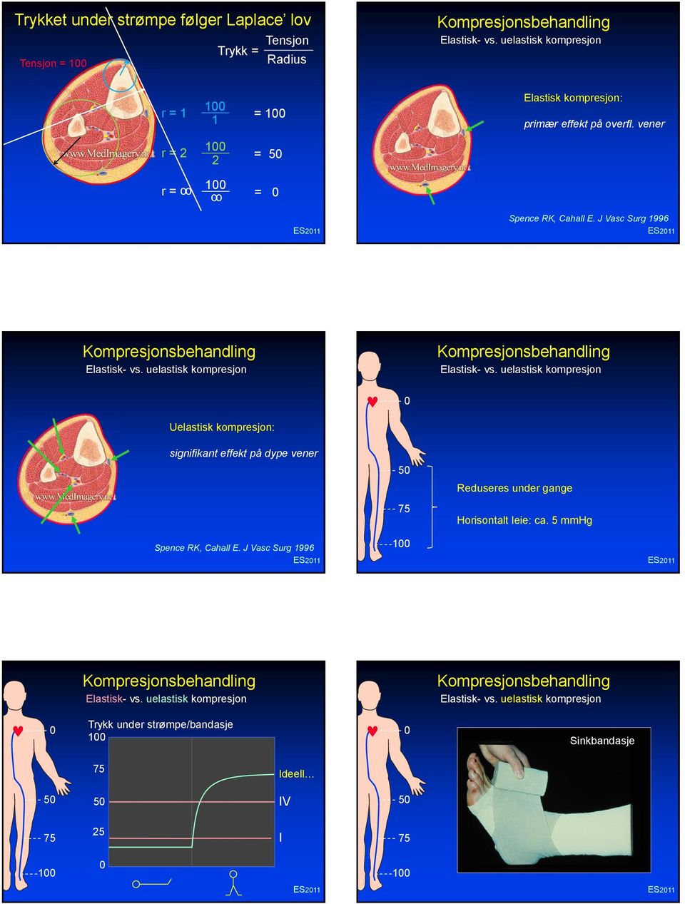 J Vasc Surg 1996 Elastisk- vs. uelastisk kompresjon Elastisk- vs.