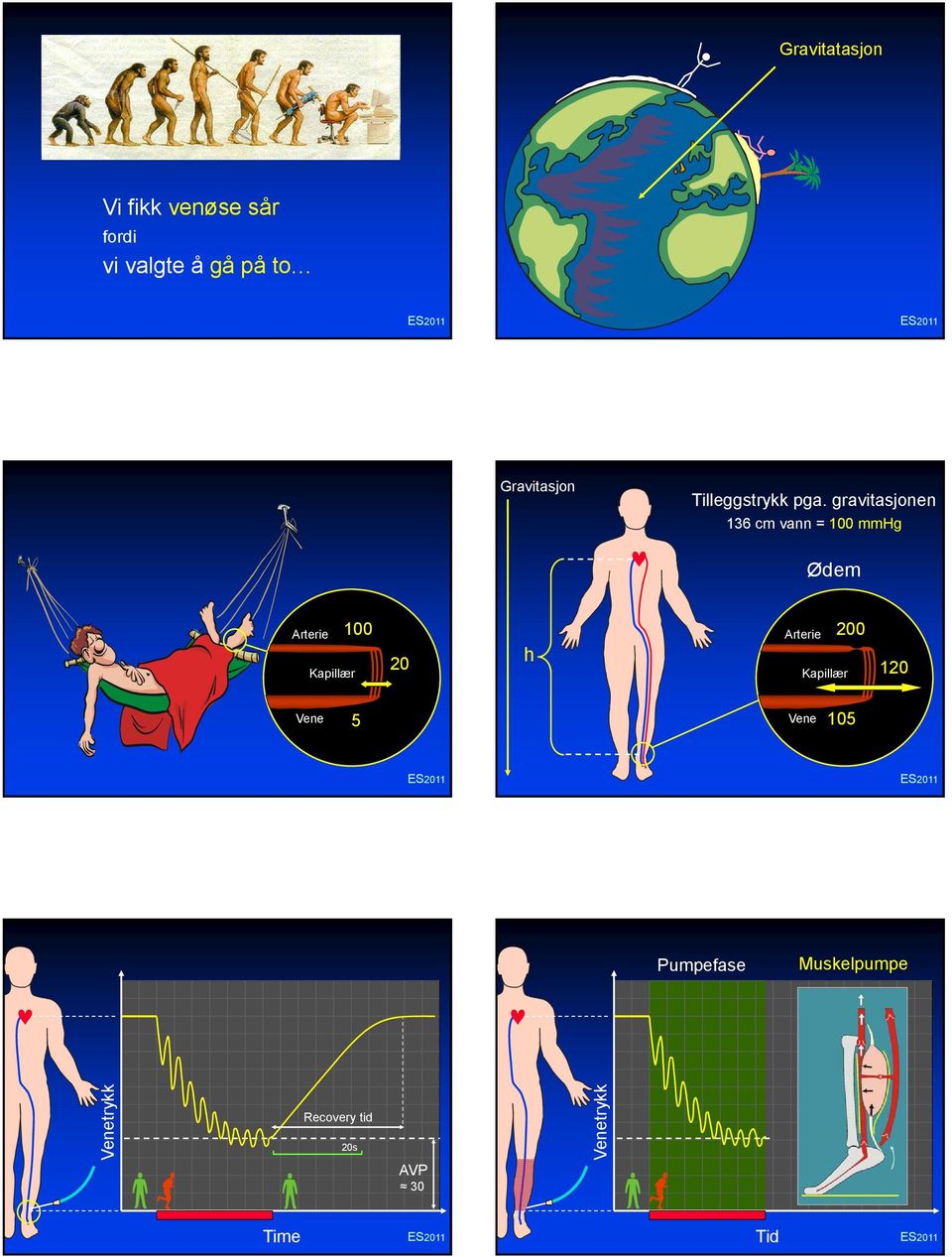 gravitasjonen 136 cm vann = 100 mmhg Ødem Arterie Kapillær 100 20 h