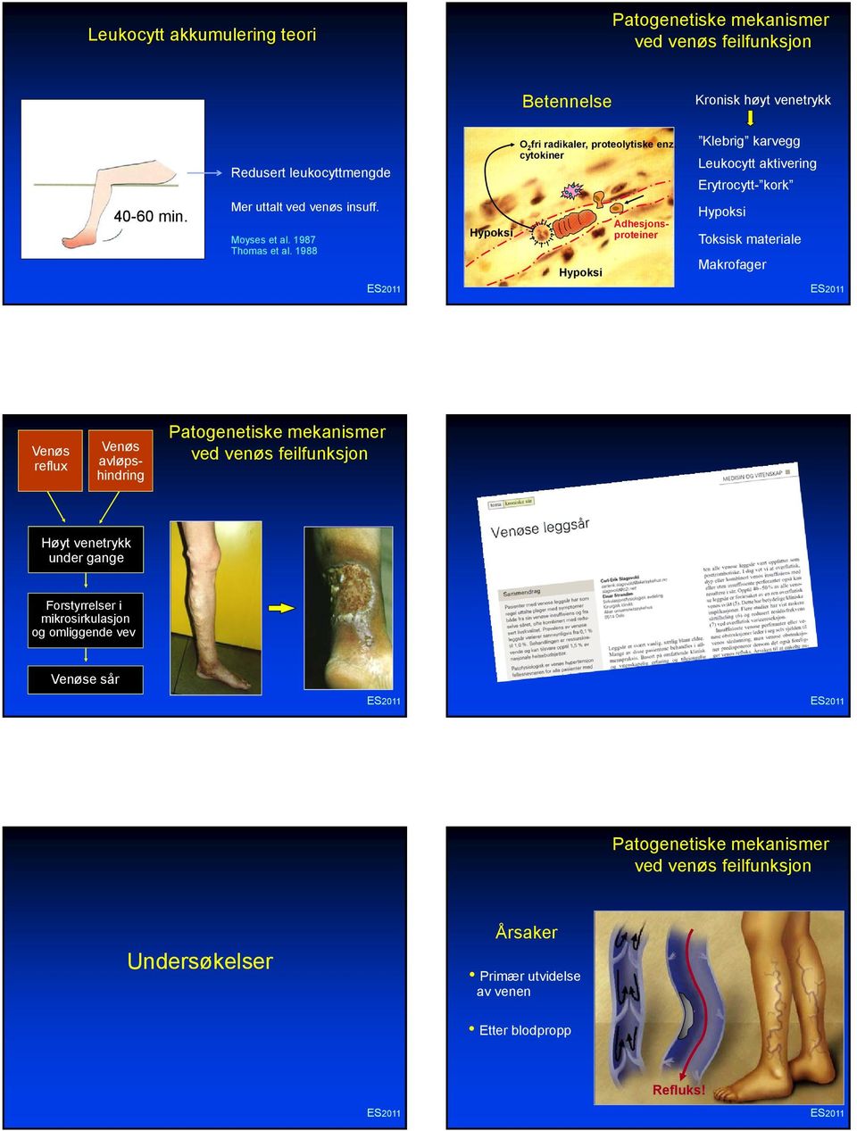 1988 Hypoksi Hypoksi Adhesjonsproteiner Hypoksi Toksisk materiale Makrofager reflux avløpshindring Patogenetiske mekanismer ved venøs feilfunksjon Høyt venetrykk
