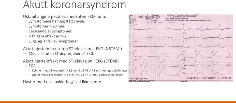Akutt hjerteinfarkt uten ST-elevasjon i EKG (NSTEMI) Med eller uten ST-depresjoner på EKG.