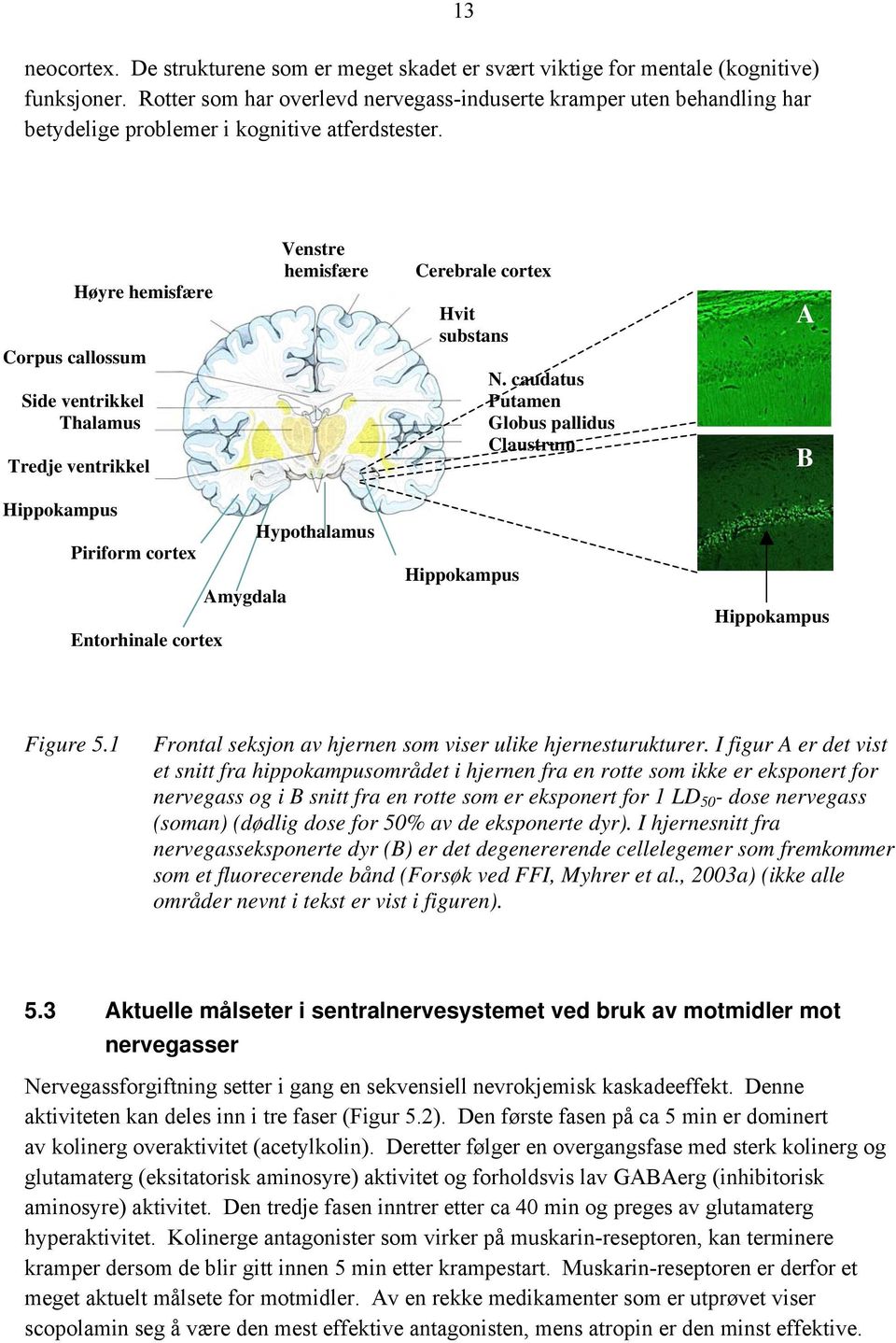 13 Høyre hemisfære Corpus callossum Side ventrikkel Thalamus Tredje ventrikkel Venstre hemisfære Cerebrale cortex Hvit substans N.