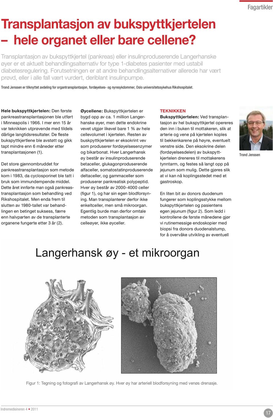 Forutsetningen er at andre behandlingsalternativer allerede har vært prøvd, eller i alle fall vært vurdert, deriblant insulinpumpe.