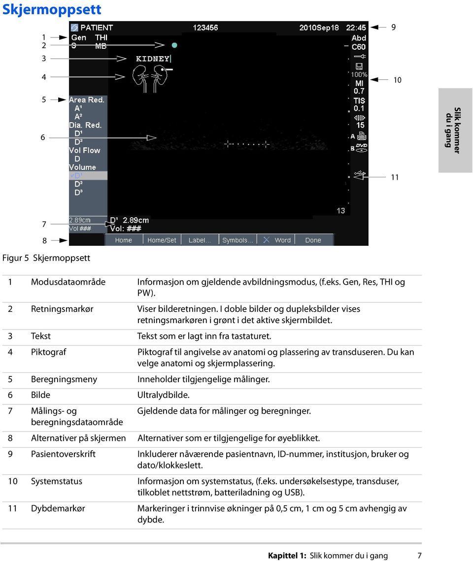 4 Piktograf Piktograf til angivelse av anatomi og plassering av transduseren. Du kan velge anatomi og skjermplassering. 5 Beregningsmeny Inneholder tilgjengelige målinger. 6 Bilde Ultralydbilde.