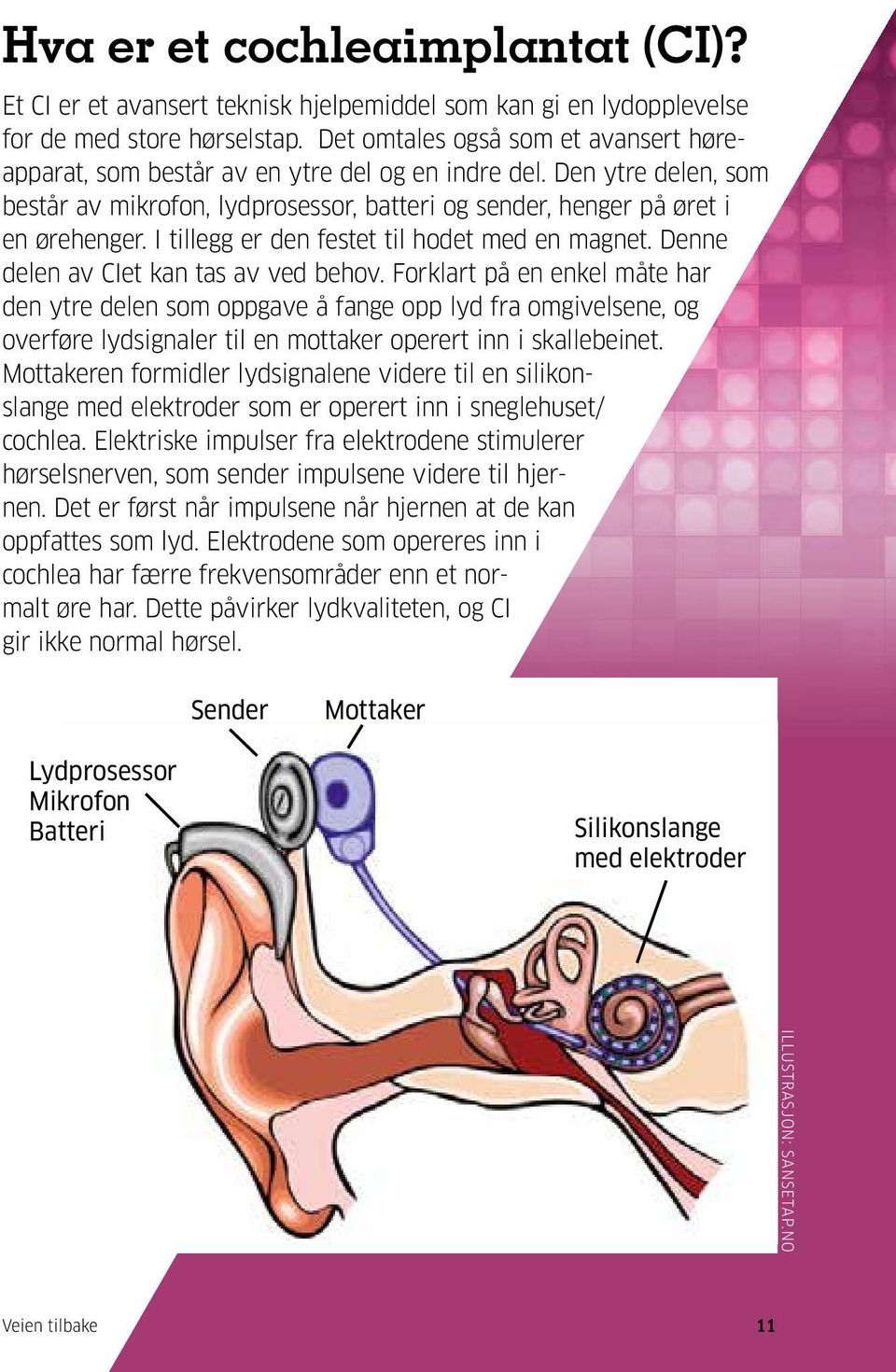 I tillegg er den festet til hodet med en magnet. Denne delen av CIet kan tas av ved behov.