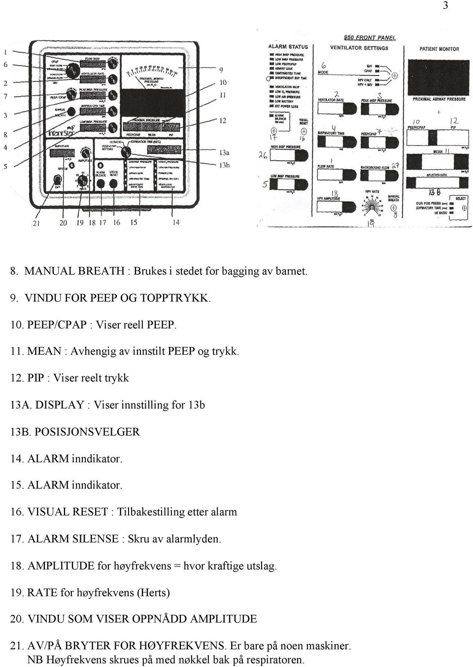 ALARM inndikator. 16. VISUAL RESET : Tilbakestilling etter alarm 17. ALARM SILENSE : Skru av alarmlyden. 18. AMPLITUDE for høyfrekvens = hvor kraftige utslag.