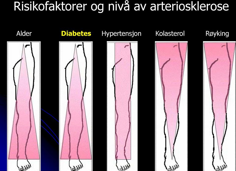 arteriosklerose Alder