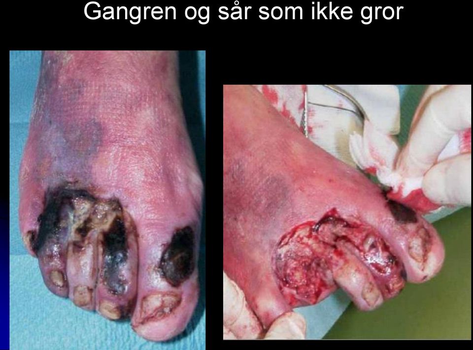 som ikke