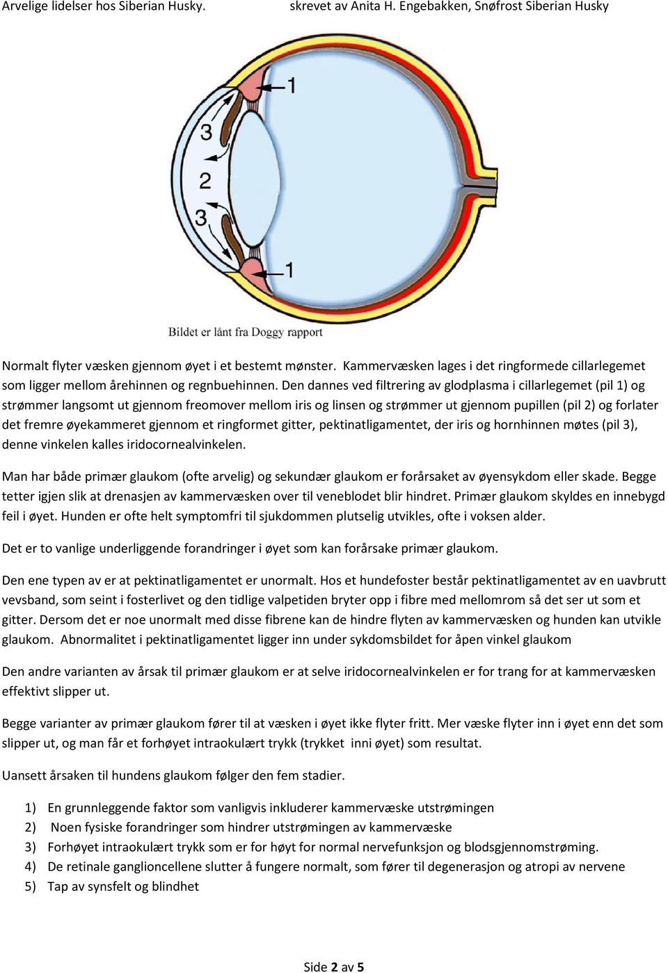 øyekammeret gjennom et ringformet gitter, pektinatligamentet, der iris og hornhinnen møtes (pil 3), denne vinkelen kalles iridocornealvinkelen.