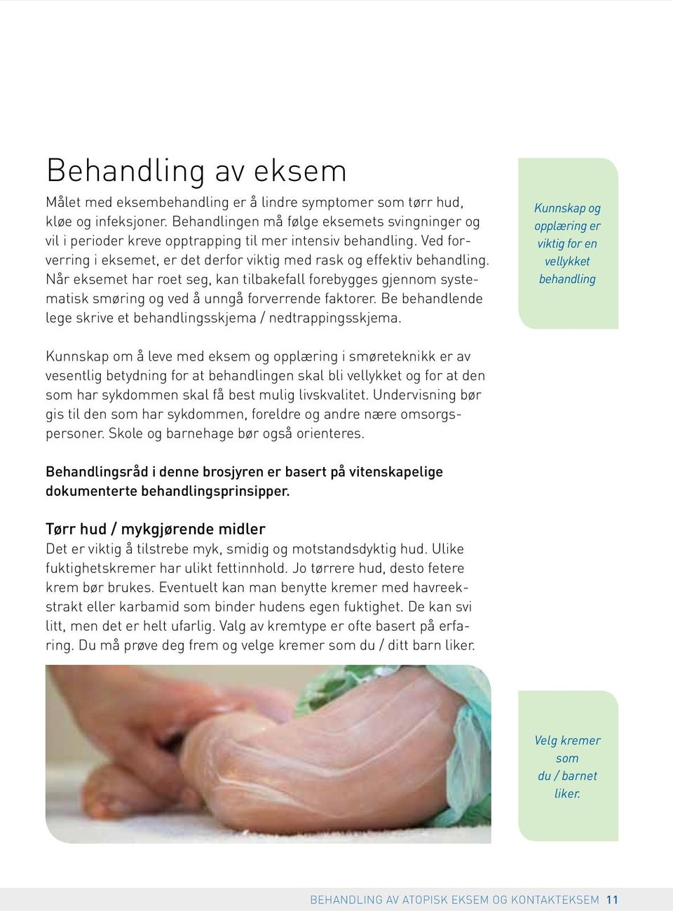 Når eksemet har roet seg, kan tilbakefall forebygges gjennom systematisk smøring og ved å unngå forverrende faktorer. Be behandlende lege skrive et behandlingsskjema / nedtrappingsskjema.