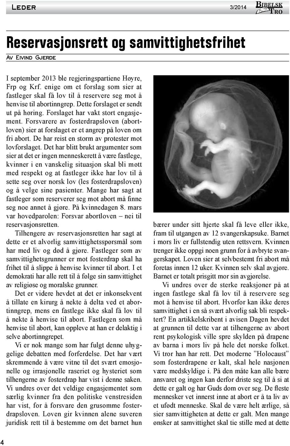 Forsvarere av fosterdrapsloven (abortloven) sier at forslaget er et angrep på loven om fri abort. De har reist en storm av protester mot lovforslaget.