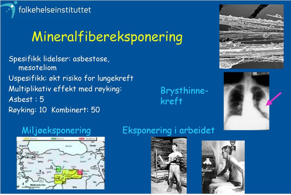 Multiplikativ effekt med røyking: Asbest : 5 Røyking: 10