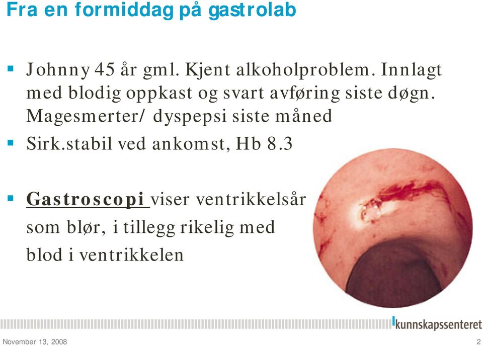 Magesmerter/ dyspepsi siste måned Sirk.stabil ved ankomst, Hb 8.