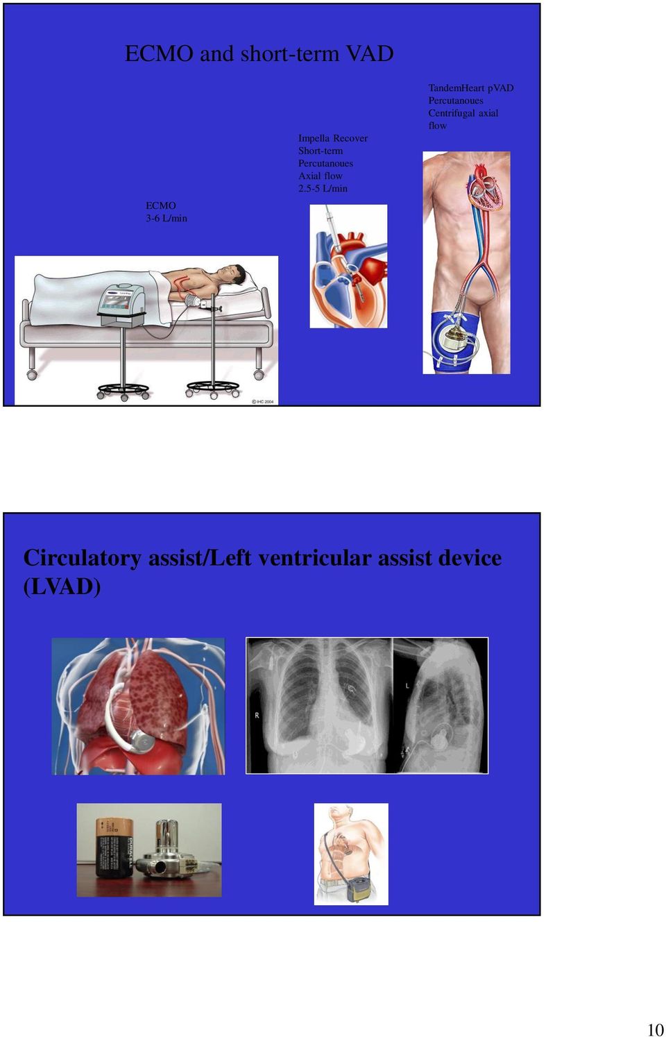 5-5 L/min TandemHeart pvad Percutanoues Centrifugal