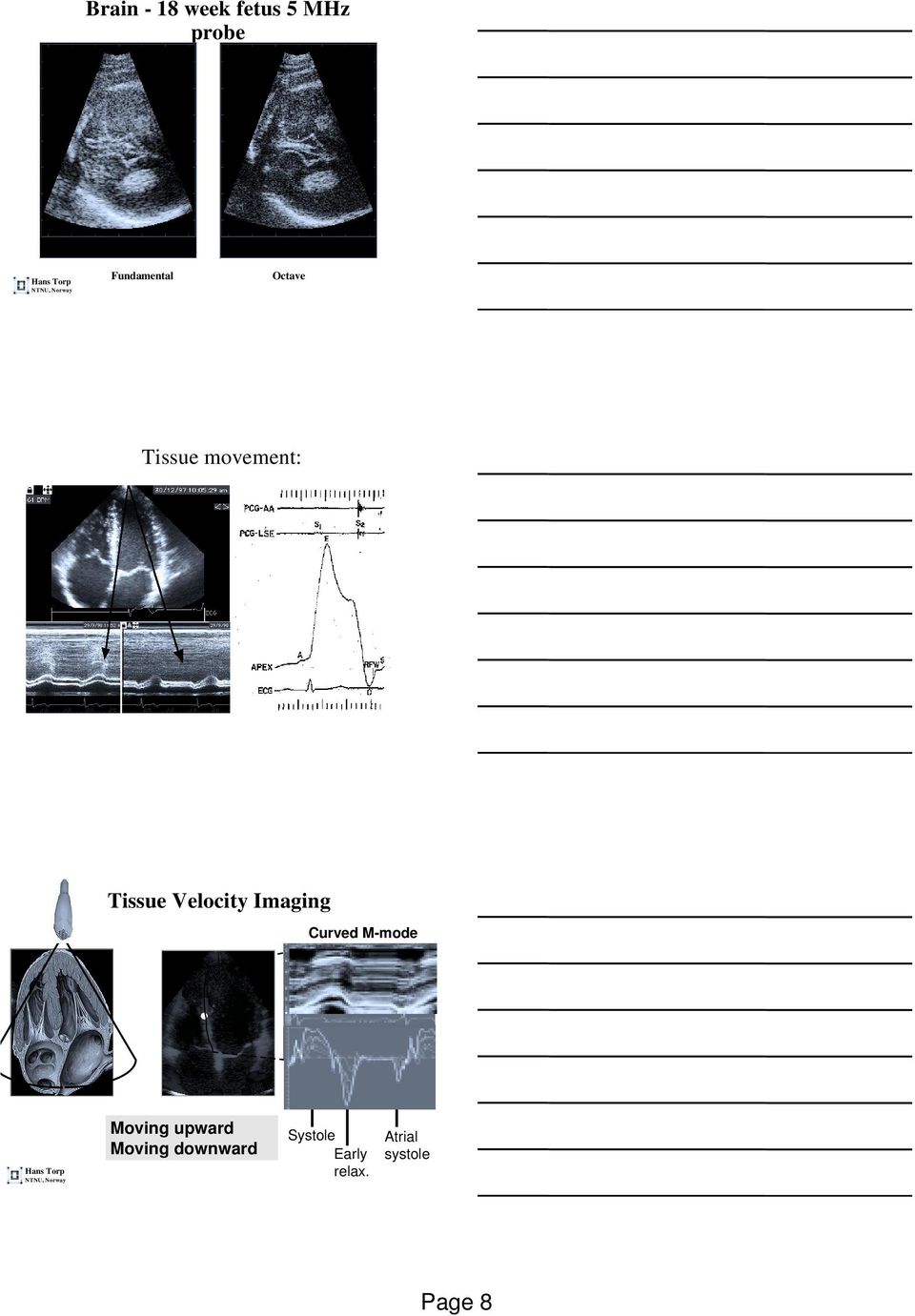 Velocity Imaging Curved M-mode Moving upward