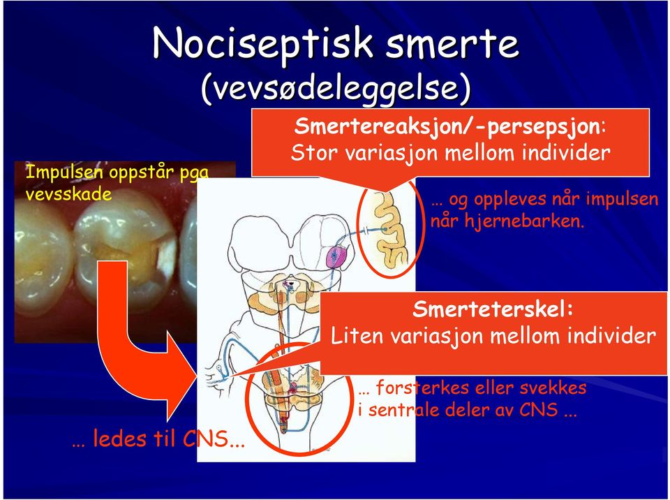 når impulsen når hjernebarken.