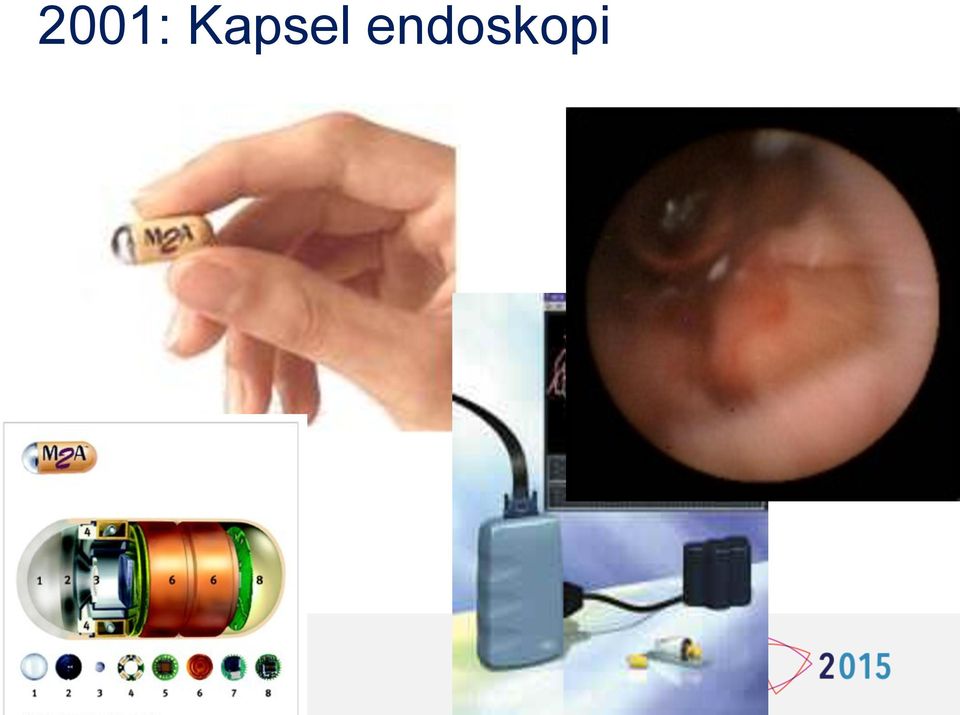 endoskopi