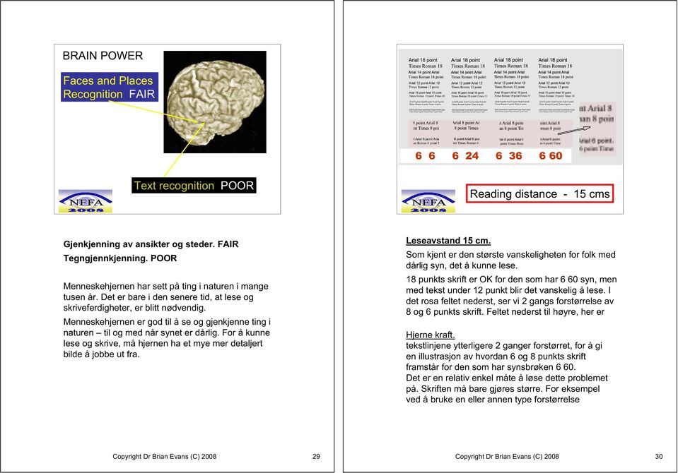 Menneskehjernen er god til å se og gjenkjenne ting i naturen til og med når synet er dårlig. For å kunne lese og skrive, må hjernen ha et mye mer detaljert bilde å jobbe ut fra. Leseavstand 15 cm.