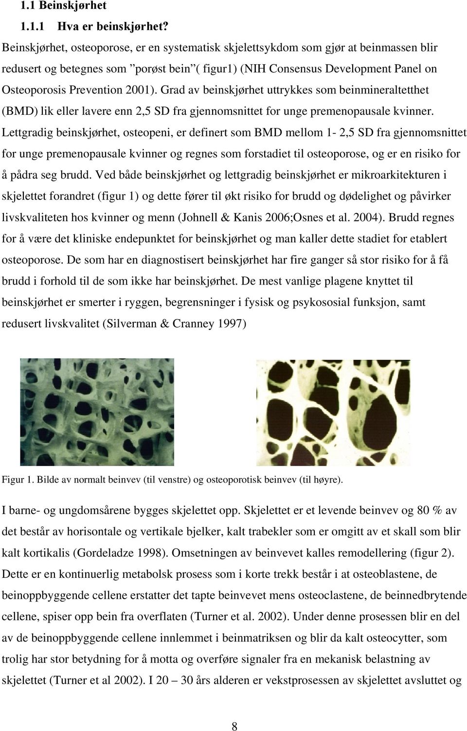 2001). Grad av beinskjørhet uttrykkes som beinmineraltetthet (BMD) lik eller lavere enn 2,5 SD fra gjennomsnittet for unge premenopausale kvinner.