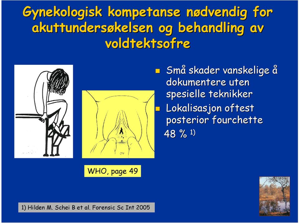 uten spesielle teknikker Lokalisasjon oftest posterior fourchette