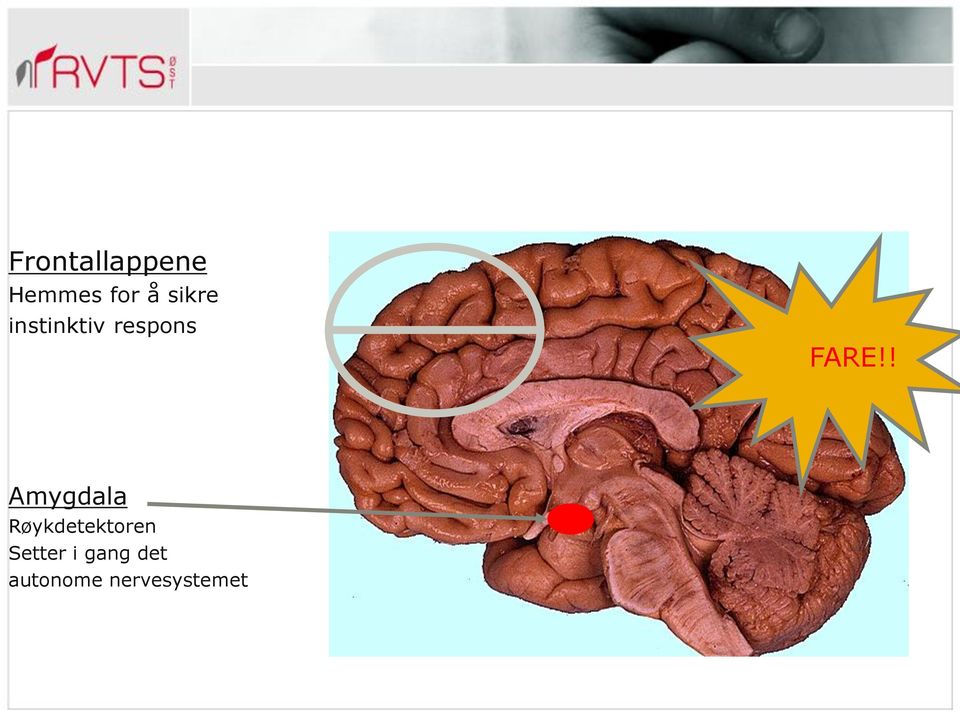 ! Amygdala Røykdetektoren