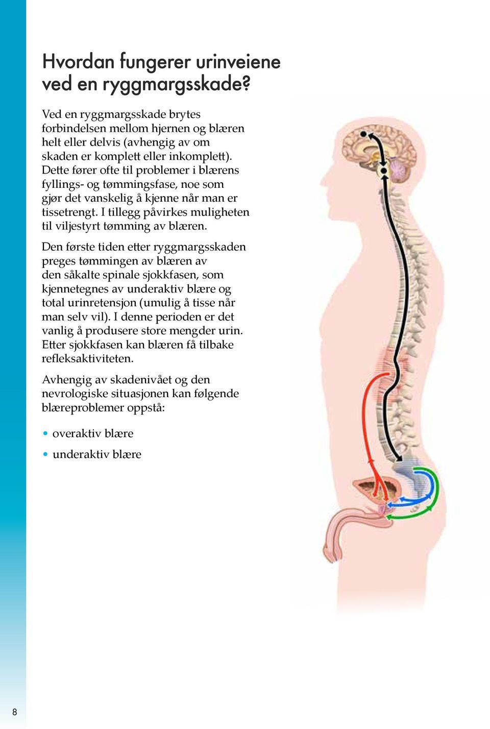 Den første tiden etter ryggmargsskaden preges tømmingen av blæren av den såkalte spinale sjokkfasen, som kjennetegnes av underaktiv blære og total urinretensjon (umulig å tisse når man selv vil).