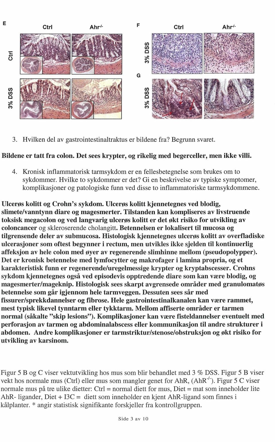 Gi en beskrivelse av typiske symptomer, komplikasjoner og patologiske funn ved disse to inflarmnatoriske tarmsykdommene. Ulcerøs kolitt og Crohn s sykdom.