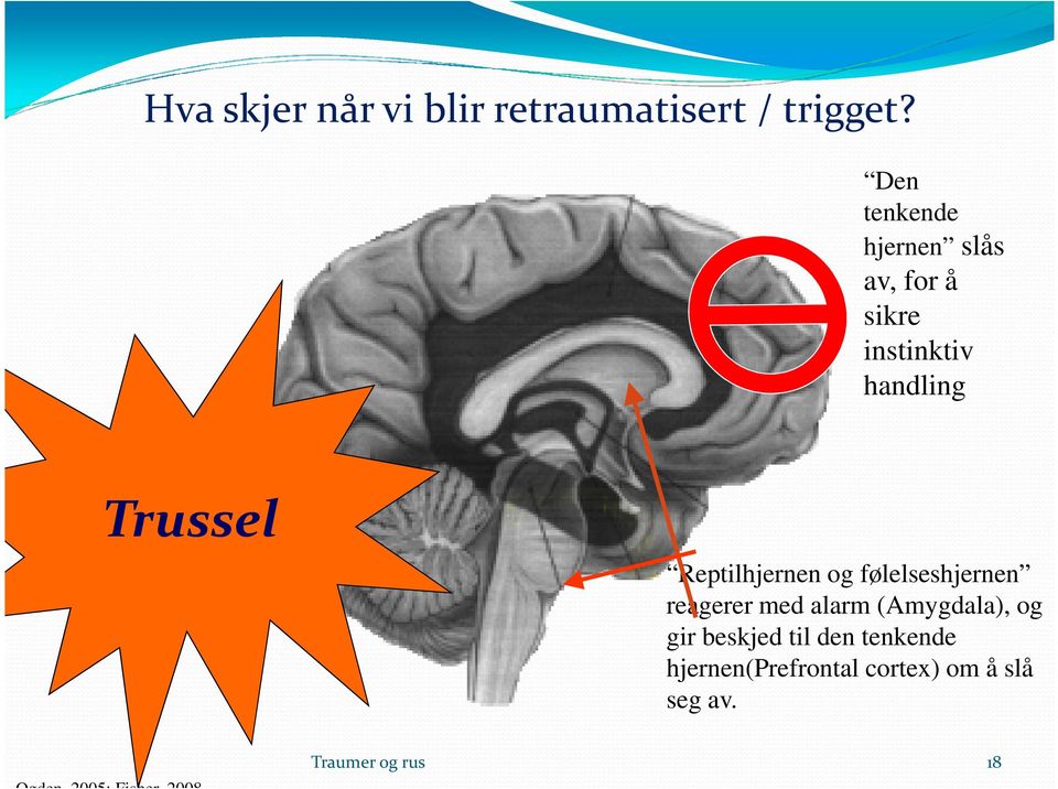 Reptilhjernen og følelseshjernen reagerer med alarm (Amygdala), og gir