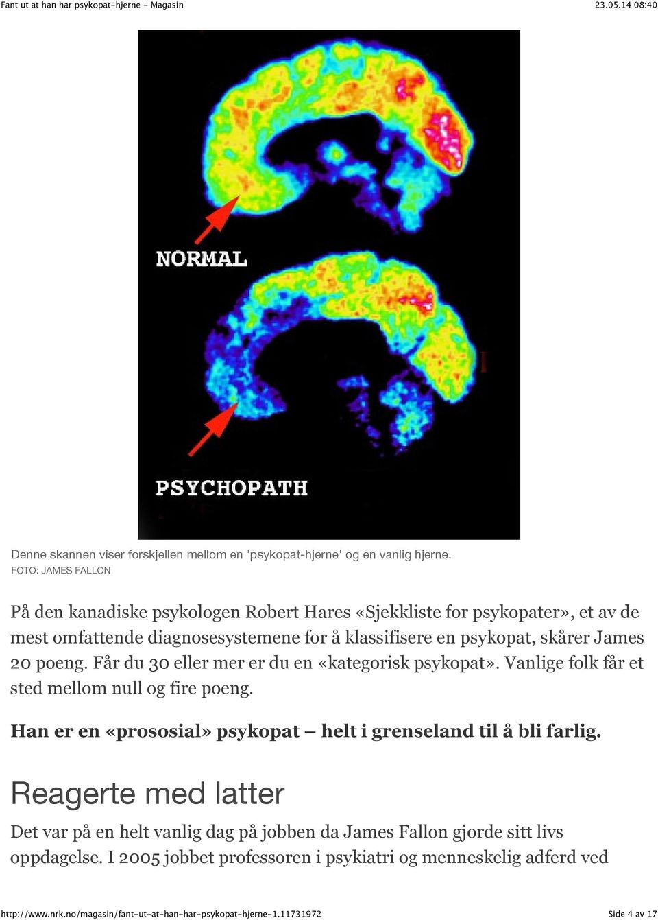 psykopat, skårer James 20 poeng. Får du 30 eller mer er du en «kategorisk psykopat». Vanlige folk får et sted mellom null og fire poeng.