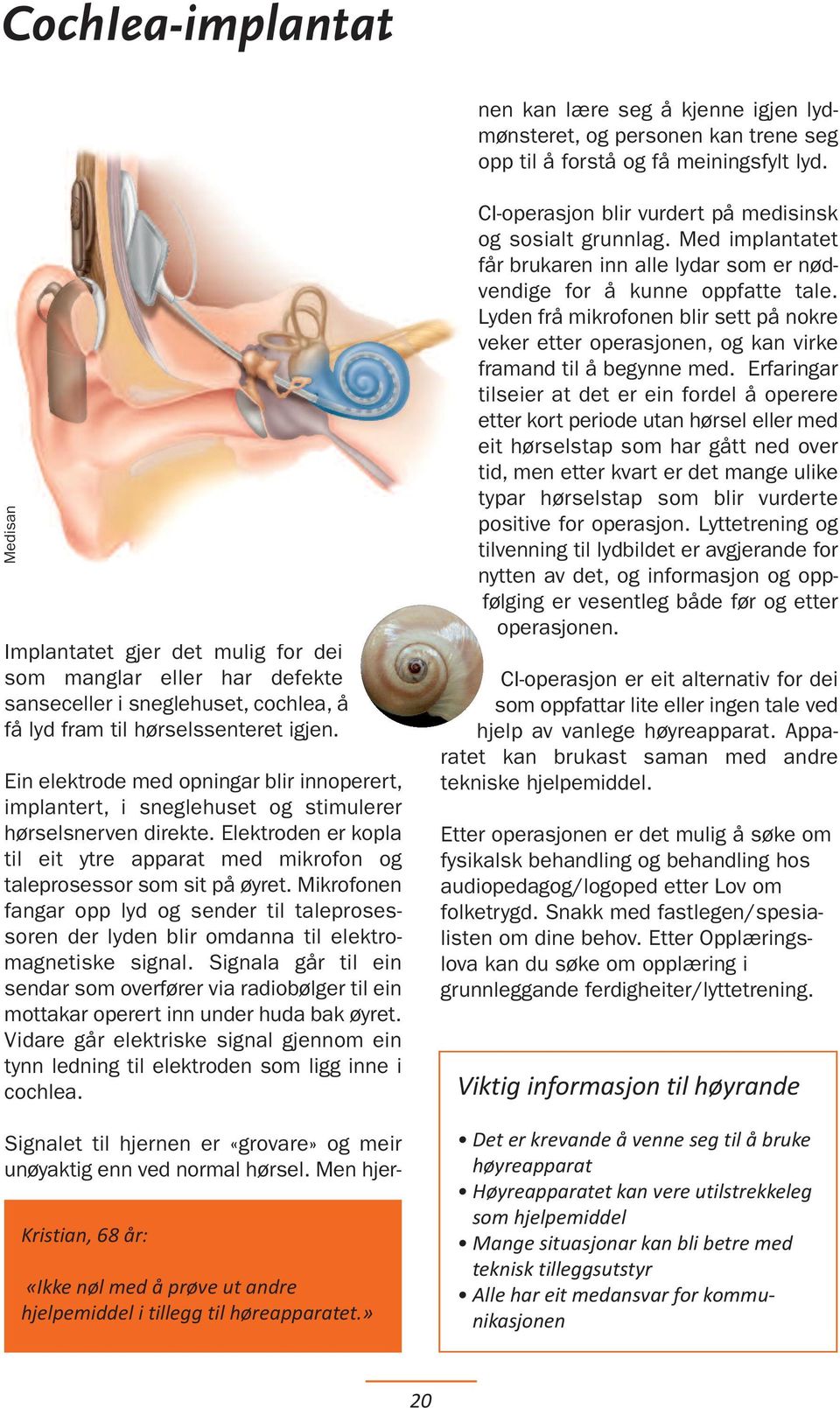Medisan Implantatet gjer det mulig for dei som manglar eller har defekte sanseceller i sneglehuset, cochlea, å få lyd fram til hørsels senteret igjen.
