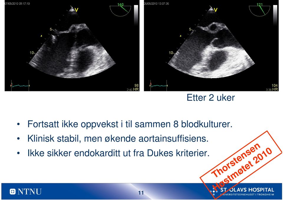 Klinisk stabil, men økende