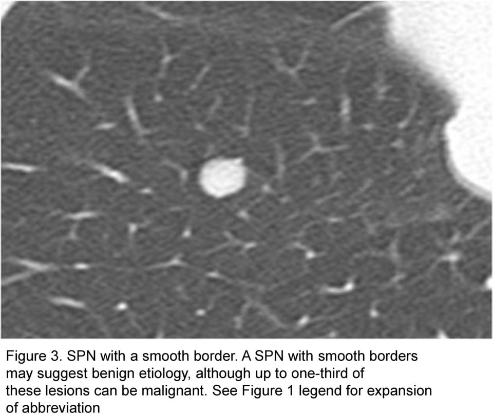 etiology, although up to one-third of these