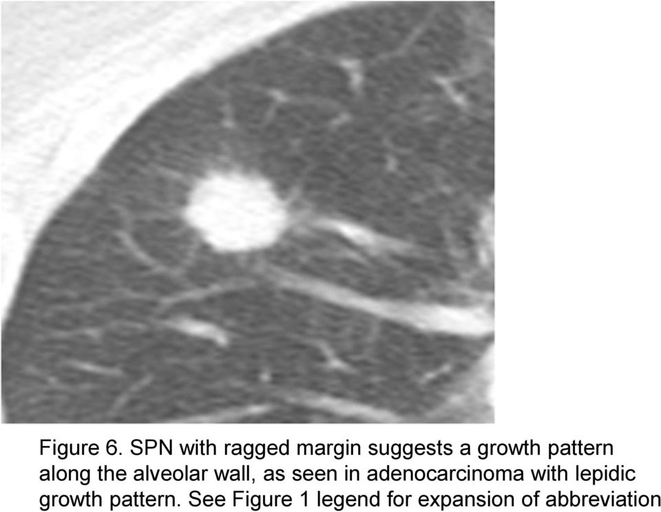 pattern along the alveolar wall, as seen in