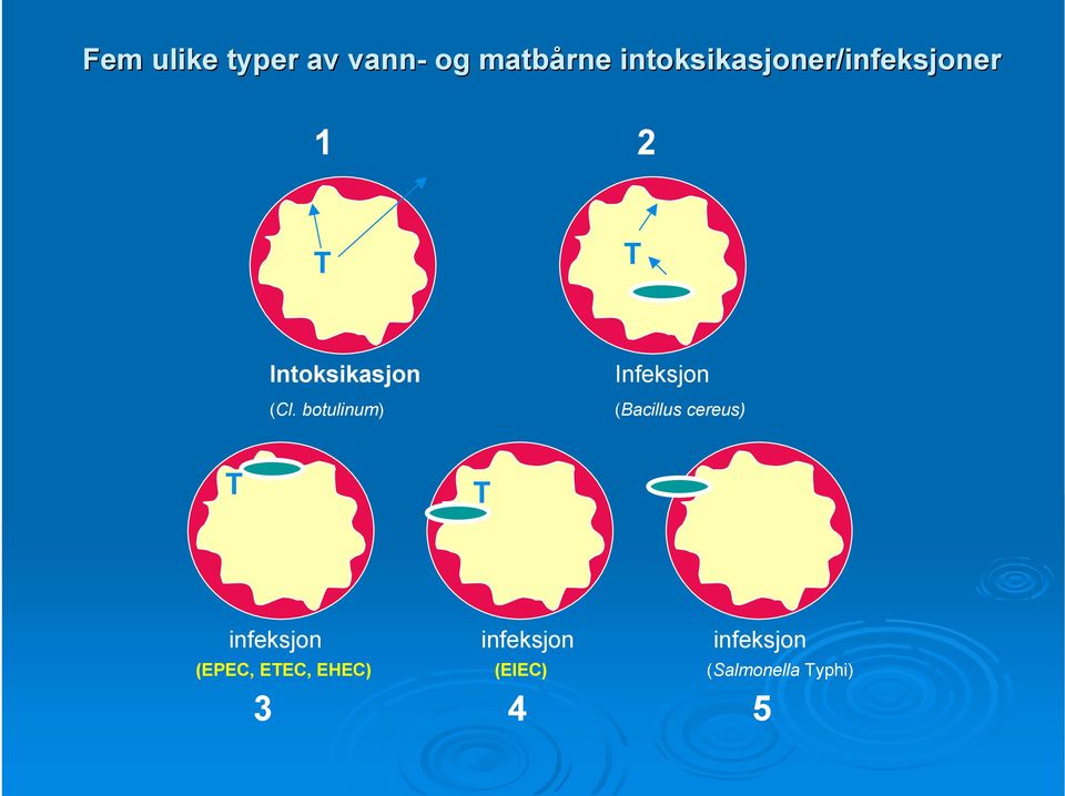 botulinum) Infeksjon (Bacillus cereus) T T infeksjon