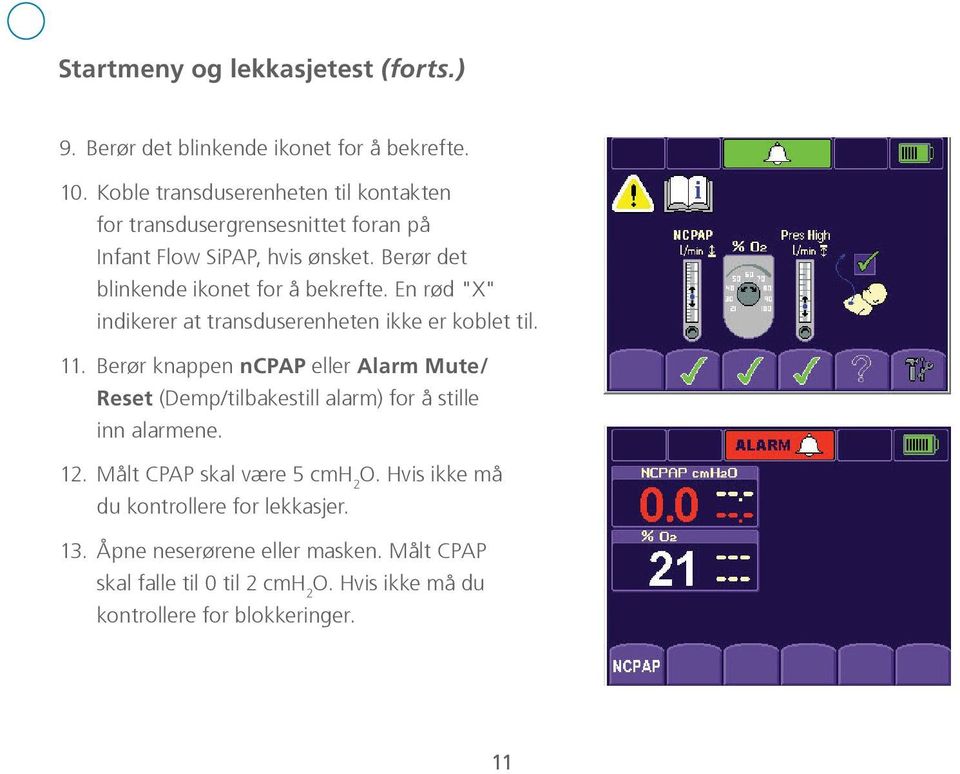 En rød "X" indikerer at transduserenheten ikke er koblet til. 11.